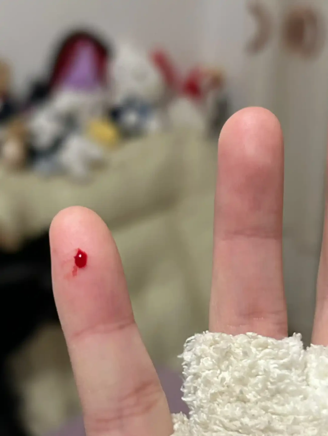 被蜜袋鼯咬出血,先别急着送人也别急着