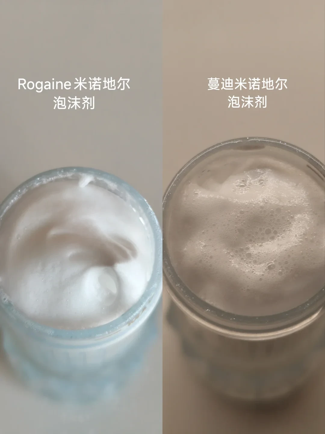 一到秋天掉发就暴增,先别急着下单米诺地尔:把