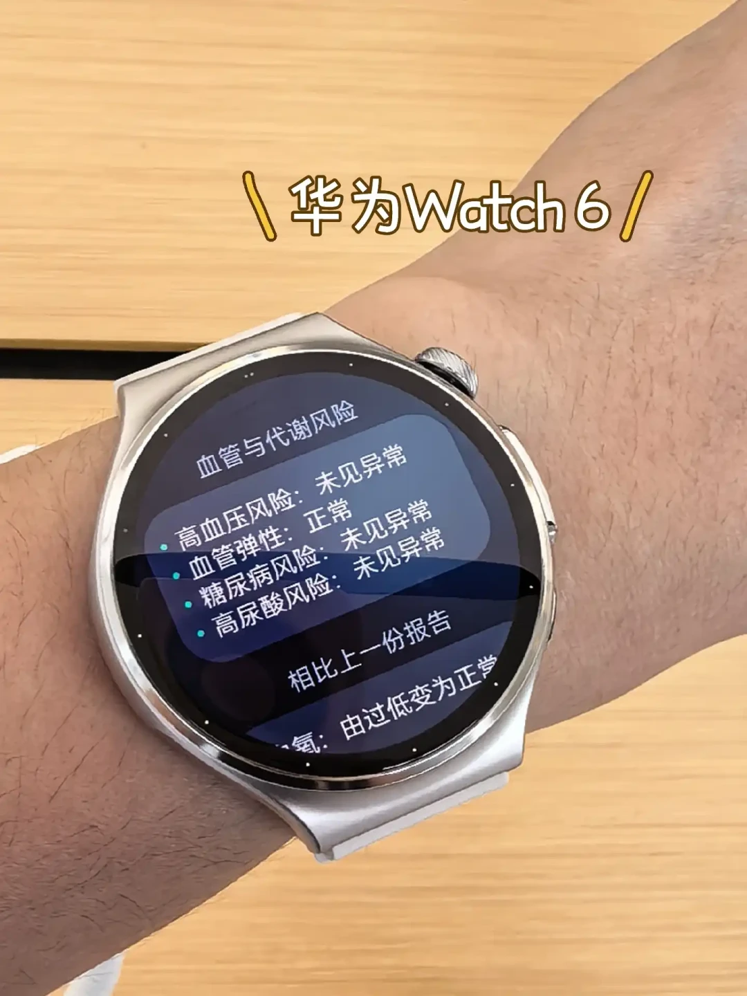 手表能“测”尿酸了?华为WATCH 6首销日刷屏,痛风党先别急着掏2799:它给的是风险等级不是数值——80.1%准确率的两面、百元尿酸仪的乱象和这笔账怎么算