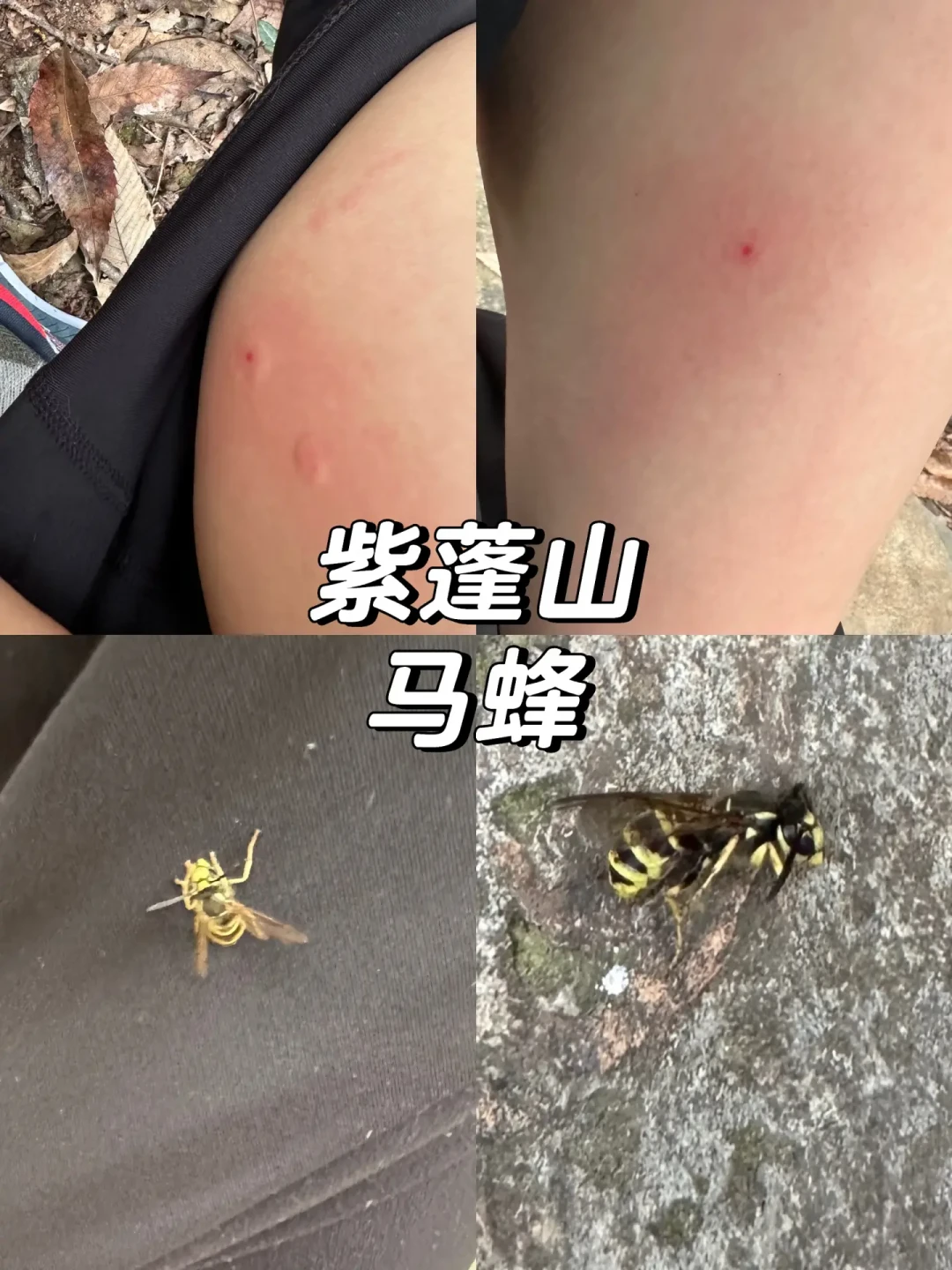 秋蜂猛如虎:被蜇700多口的兄妹案刚开庭,我发现连认证账号都把急救法教反了