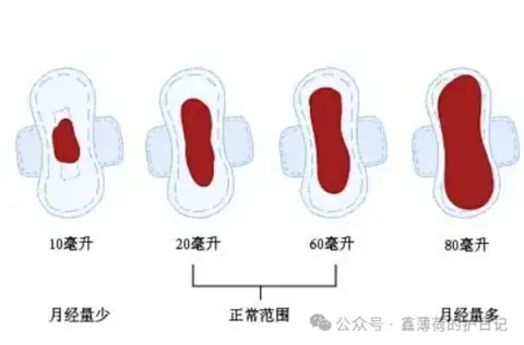 两条视频合计35万收藏的「经期排瘀操」:子宫排不出