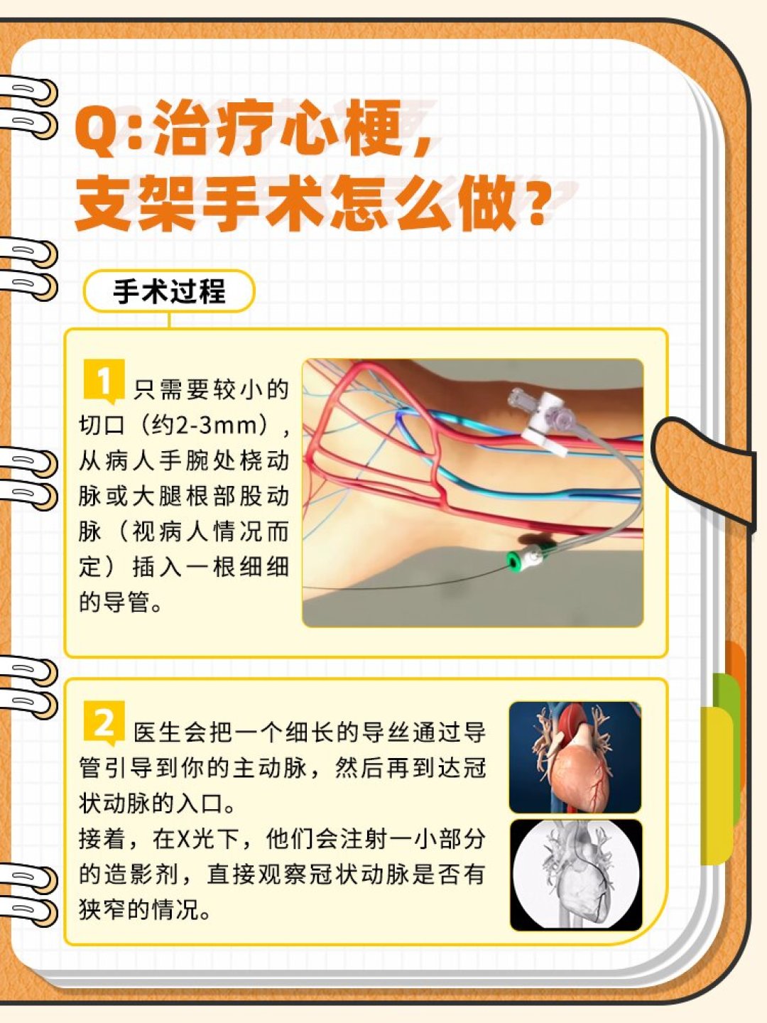 陈建州心梗发作，第一个动作是吃胃药：被热搜吓到查“胸闷”的你，这份就医判断清单收好