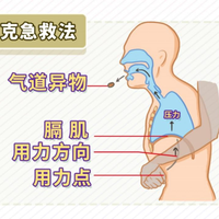 海姆立克现在要"先拍背"了：2016年"96岁去世"是假消息、2017年被《纽约时报》扒过，家长最容易搞错的5句说法我逐条核了