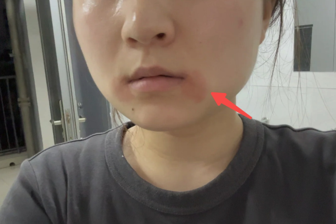 一到秋冬嘴唇就起皮、卡纹?别光舔嘴唇了,你缺的是这个