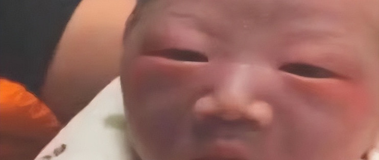 高鼻梁爸妈为啥生出塌鼻子宝宝？宝宝鼻子什么时候定型？