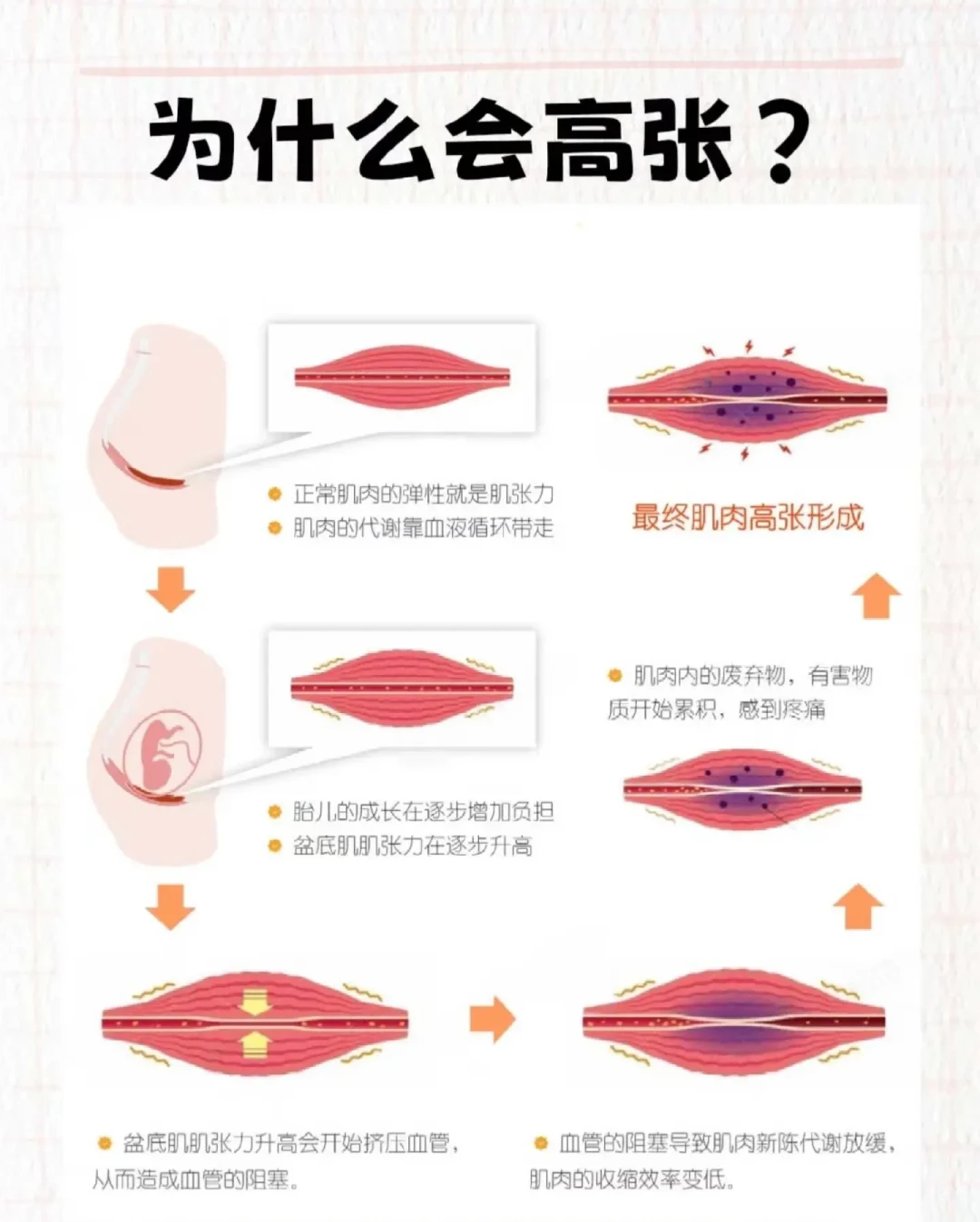 跟练说2周见效、护士说不可逆:子宫脱垂的人,先把三个参照系分清再练、再花钱