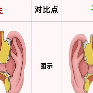 耳朵痒、油、长痘？你可能一直护理错了