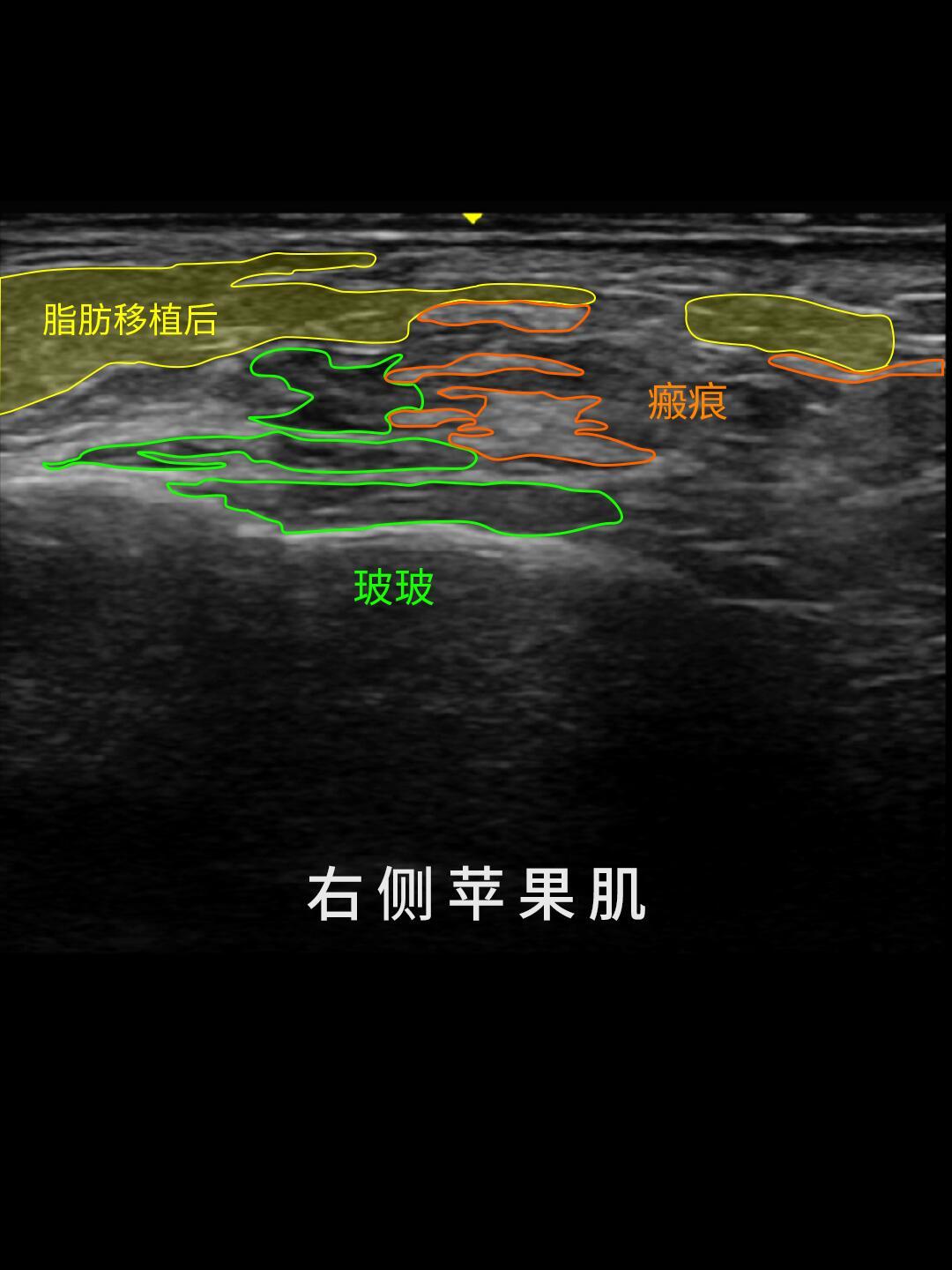 陈小纭