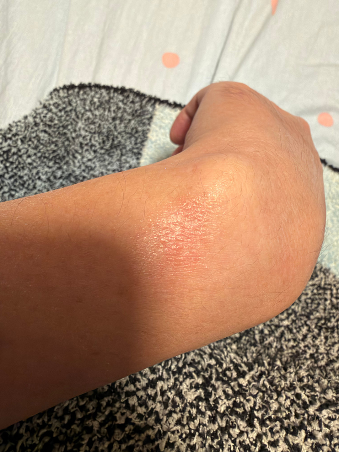 新手表戴出红肿刺痛：S12这口锅，传感器暂时背不上