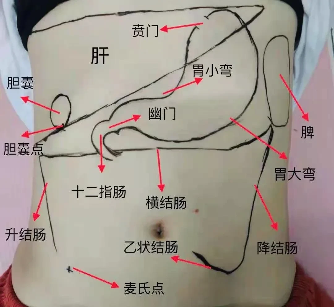 「248颗胆结石」新闻吓坏早餐党,对完医生原话才发现:不吃早餐只是5项风险之一,真正要防的是这3件事