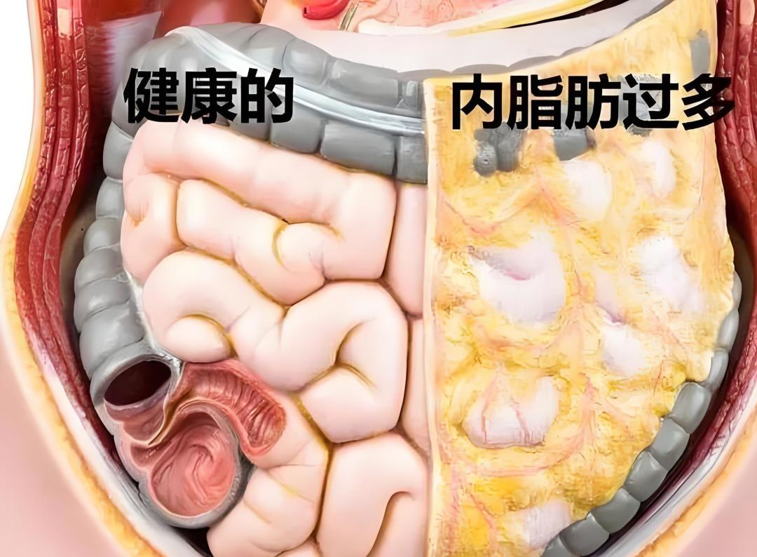 练得挺勤,体检却查出脂肪肝?这个箭头要消,得先过这三关