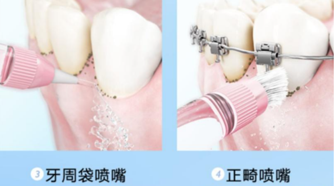 冲牙器今晚8点开启预售:我把15条一手故障样本和洁碧的“寿命2-3年”摆在一起——双11真正的坑不是智商税,是“过保即坏”