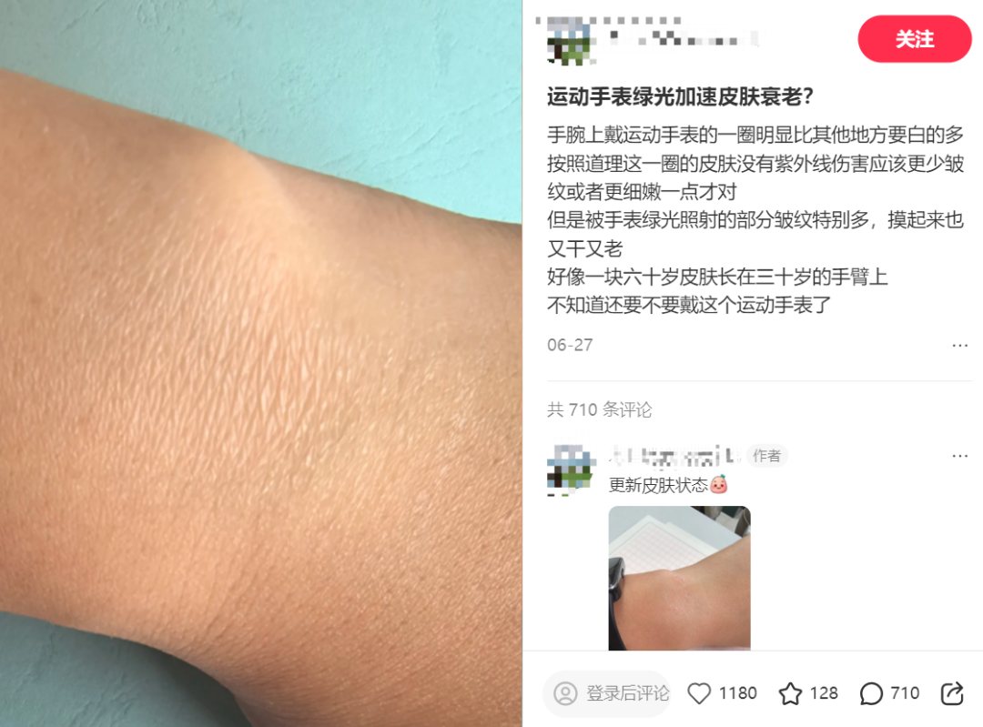 手表戴出一圈