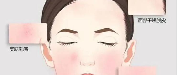 皮肤屏障，是护肤的基础