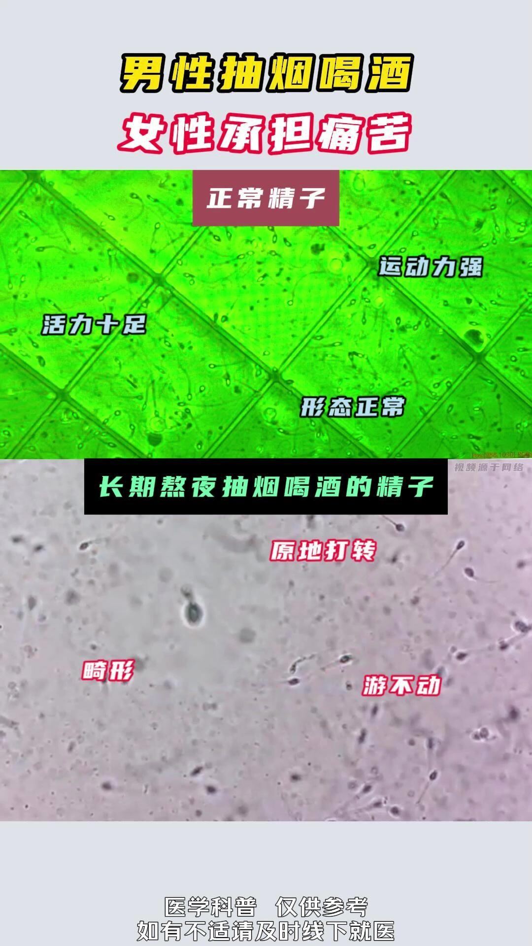 妻子流产4次她把检查做全了,先让老公看懂精液报告上的3个数字