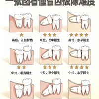 拔过智齿的都懂:这玩意儿绝对是人体最反人类的设计