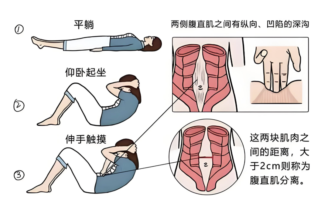 松下去的小腹,已经被盯上很久了:小红书Top40帖3帖收藏破10万、6帖在带货,先别付机构的16800,去做那个B超