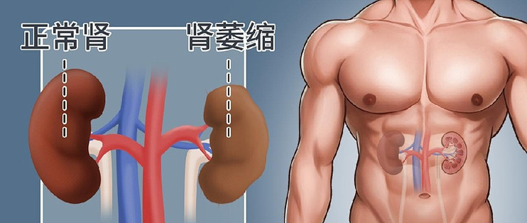 向佐35岁肾龄70岁？中年男人护肾，最该防的是“瞎补”