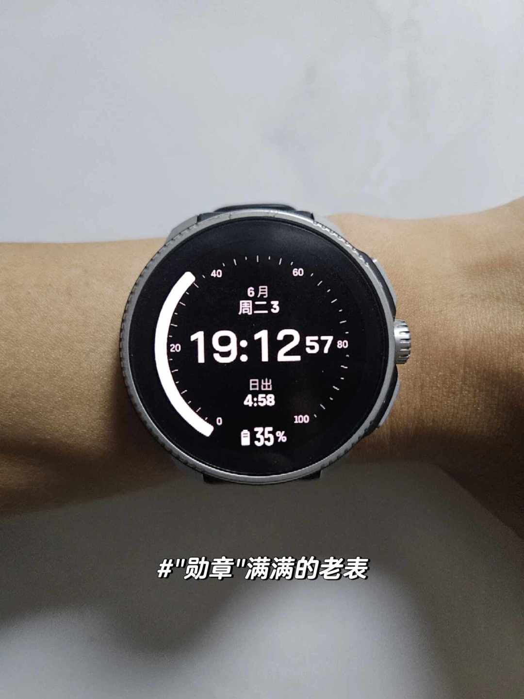 把颂拓的二十几条故障贴摆在一起：心率飙、掉电、卡路里卡死，哪些是偶发、哪些是规律？双11付尾款前，先走一遍售后路线
