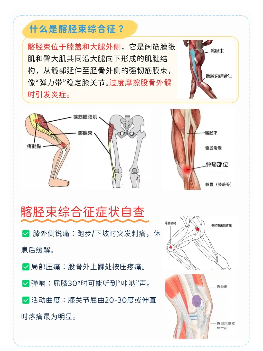 北马明天鸣枪,下周运动医学科会挤满跑者:膝盖疼分三种,“休息两天就好”恰恰是最迷惑的一种