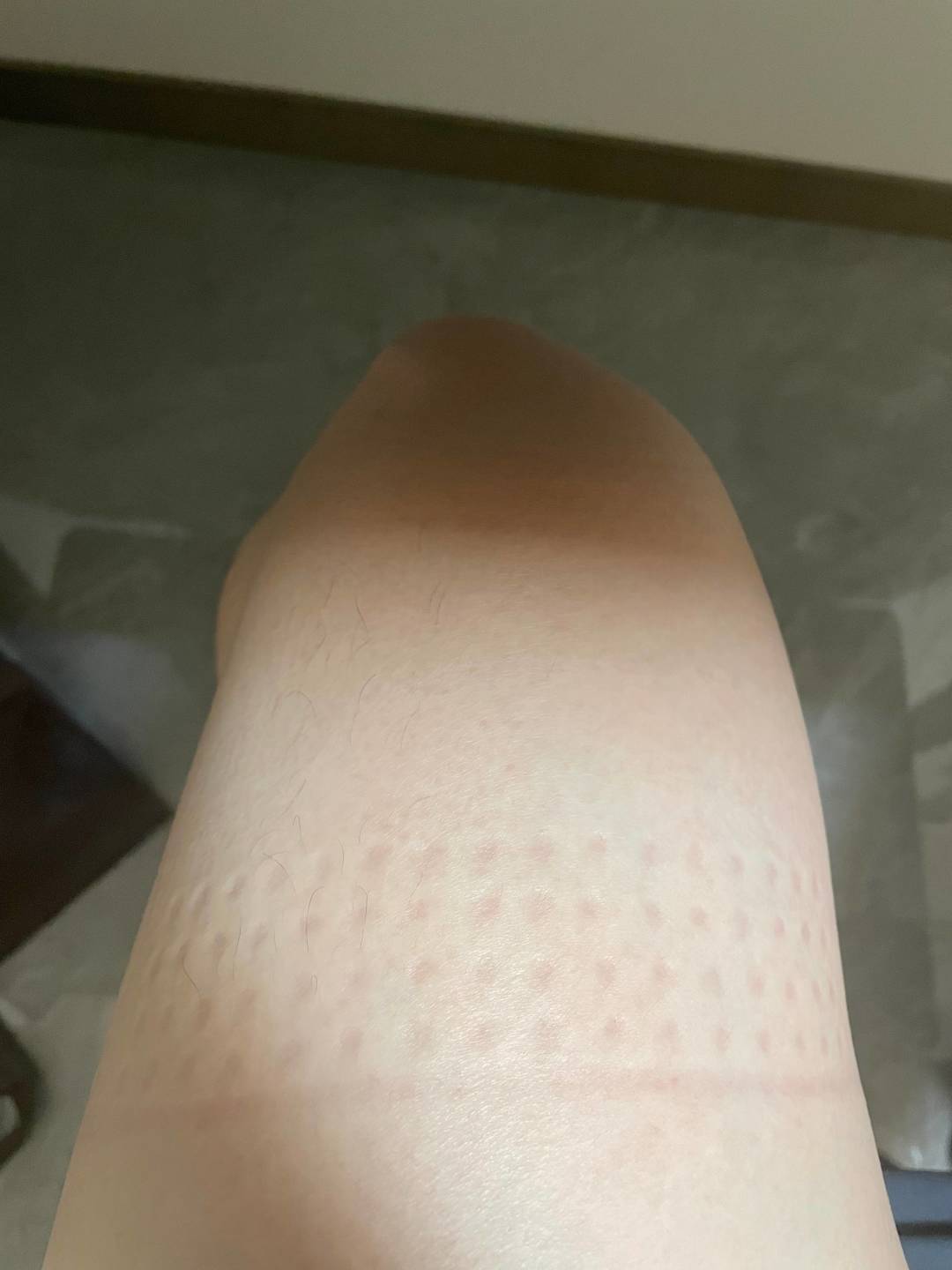 一降温,膝盖就先疼:寒凉只是音量键,这2个动作比囤护膝管用