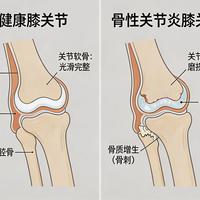 一降温，膝盖就先疼：寒凉只是音量键，这2个动作比囤护膝管用