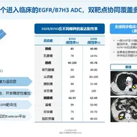 信达双抗ADC首批人体数据亮相ESMO：4个数值得看，2个先别吹