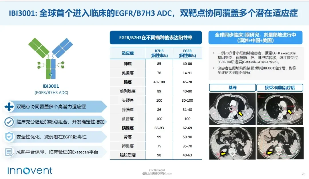 GSK甩出61%、信达掏出28%:ESMO开场先别比大小,盯数据的股民要核这4本账