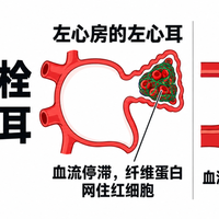 有人给爸妈囤两年拜耳阿司匹林：这药是救命药，也可能"白吃还倒贴"