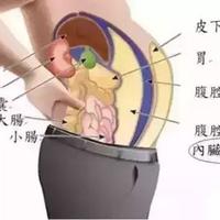 体重不超标、四肢不粗，就肚子支棱着？“我不胖”遮不住久坐攒下的内脏脂肪，机制是肌肉太少、消耗太低：先量腰围90cm线和腰高比0.5判断自己超没超，报告干净就别节食、做身体重组——每周2次全身力量（椅子深蹲/上斜俯卧撑/背包划船/臀桥，膝盖腰不好有替代动作）+饭后走10-15分钟、减酒戒液体糖，每两周量一次腰围看动静；报告上已有脂肪肝、血糖、血脂箭头的，先拿报告看医生，训练只做辅助