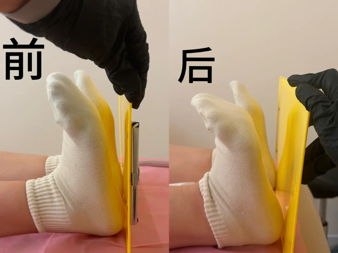深蹲蹲不下去、脚跟抬起?先别怀疑膝盖,多半是踝背屈受限:1分钟靠墙碰膝自测,10厘米碰不到就用三个动作打开,垫脚跟蹲先把腿保住练;腹股沟深处夹痛、脚踝锐痛肿胀的先去医院