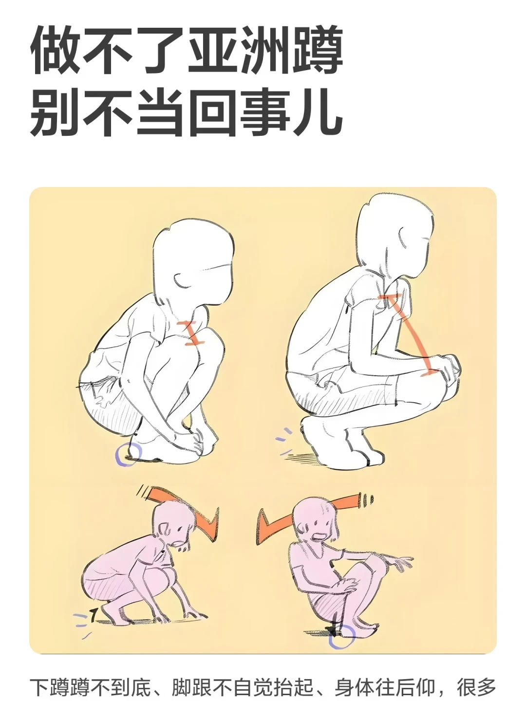 深蹲蹲不下去、脚跟抬起?先别怀疑膝盖,多半是踝背屈受限:1分钟靠墙碰膝自测,10厘米碰不到就用三个动作打开,垫脚跟蹲先把腿保住练;腹股沟深处夹痛、脚踝锐痛肿胀的先去医院