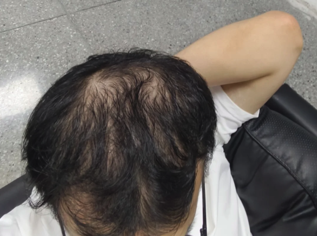 洗完头自然风干更防脱?错了,湿着头发不吹反而更伤
