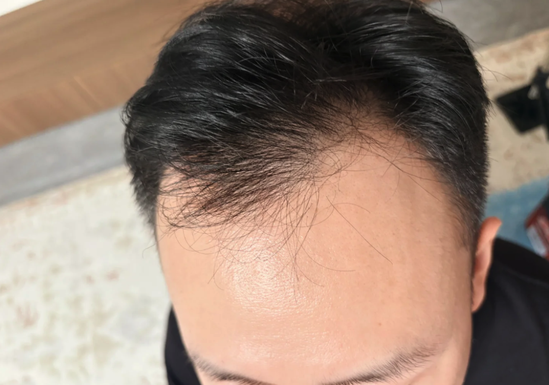 洗完头自然风干更防脱?错了,湿着头发不吹反而更伤