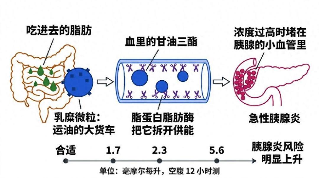 42岁体检单甘油三酯2.6，别指望鱼油救：先改这周怎么练