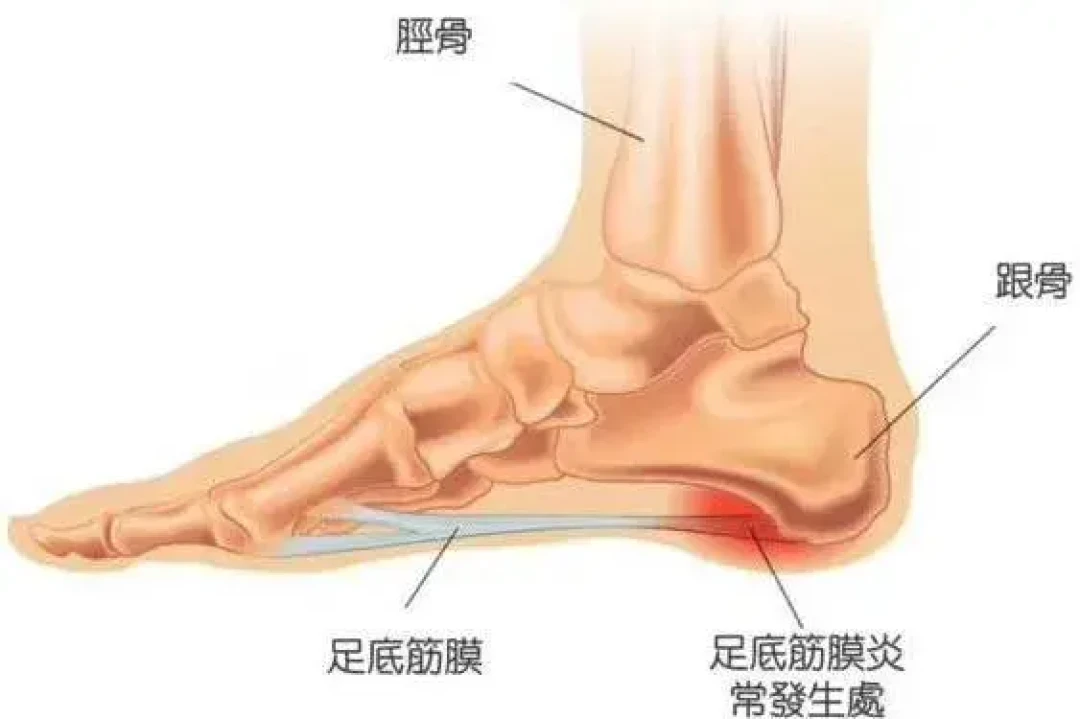 体测提分神话被辟谣!校园顶碳风,别让学生鞋进课堂