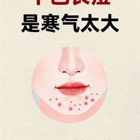 下巴反复长痘,真的是身体寒气太重吗?真正原因可能和这些有关!