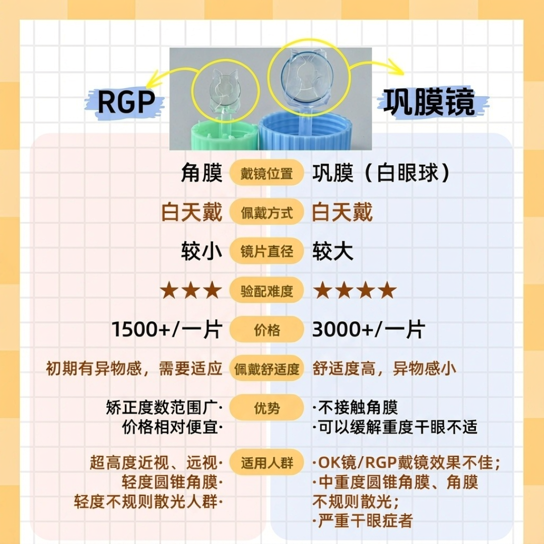 库里聊起圆锥角膜、配镜师说“没有美尼康Z了”:三十多条真实记录,这本“看清”账我一次摊开