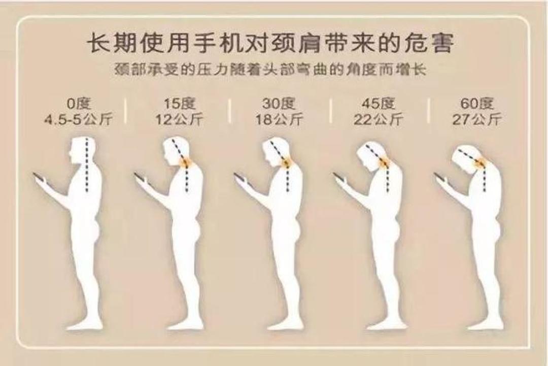 40岁肩颈操只管两小时:低头60度,颈椎扛27公斤