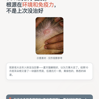 猫癣一入秋就复发？多猫家庭要治的不是那一只，是这一屋子