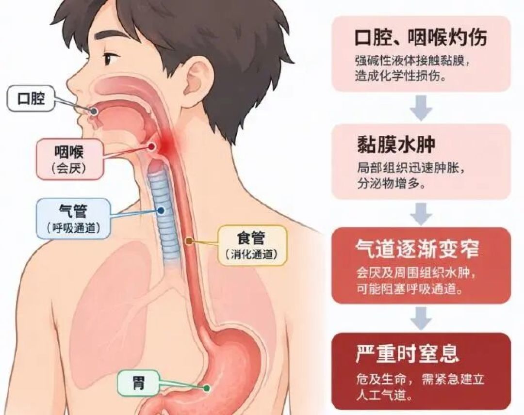 爷爷怕饮料坏了先替孙子尝一口,竟是洁厕慕斯:家里有老人小孩,先翻卫生间柜子
