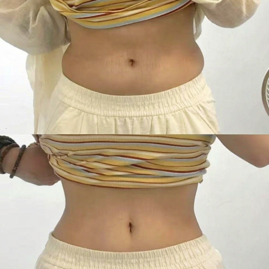 「女生练出的不是马甲线是大胃袋」冲上热搜:这4种鼓肚子是4件事,第5种别再练了