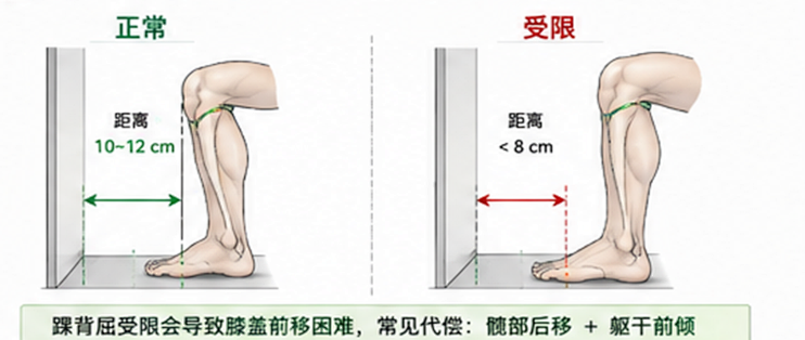 久坐上班族深蹲膝盖内扣：先砍30%重量，臀中肌往后放