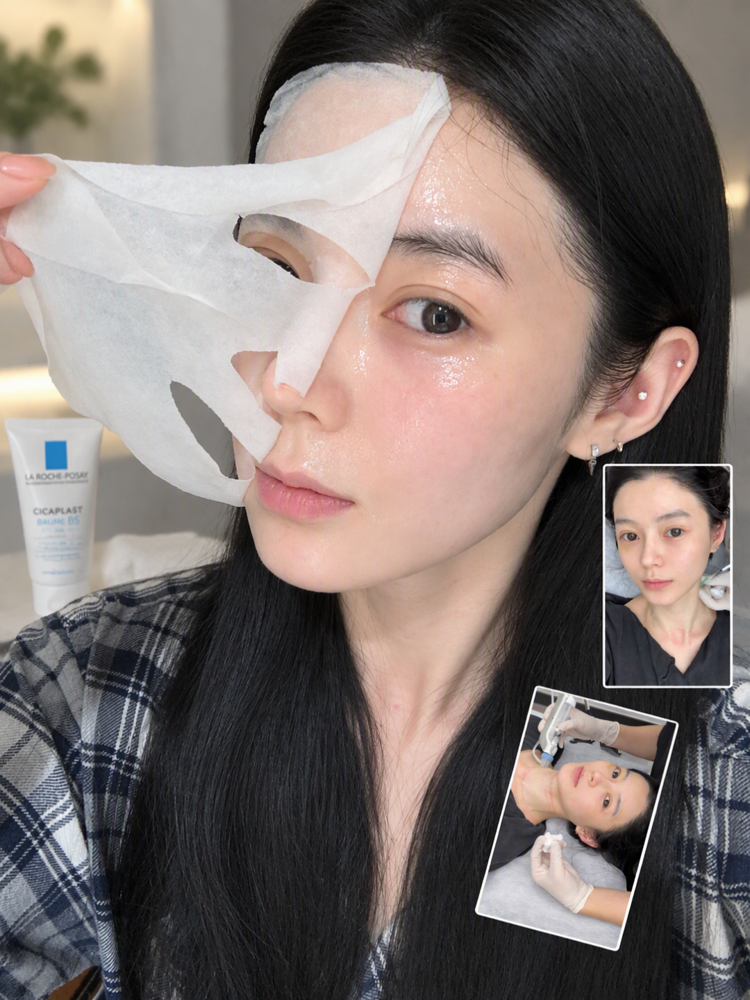 do脸后脸又红又烫，别急着敷面膜：项目修护就三个阶段