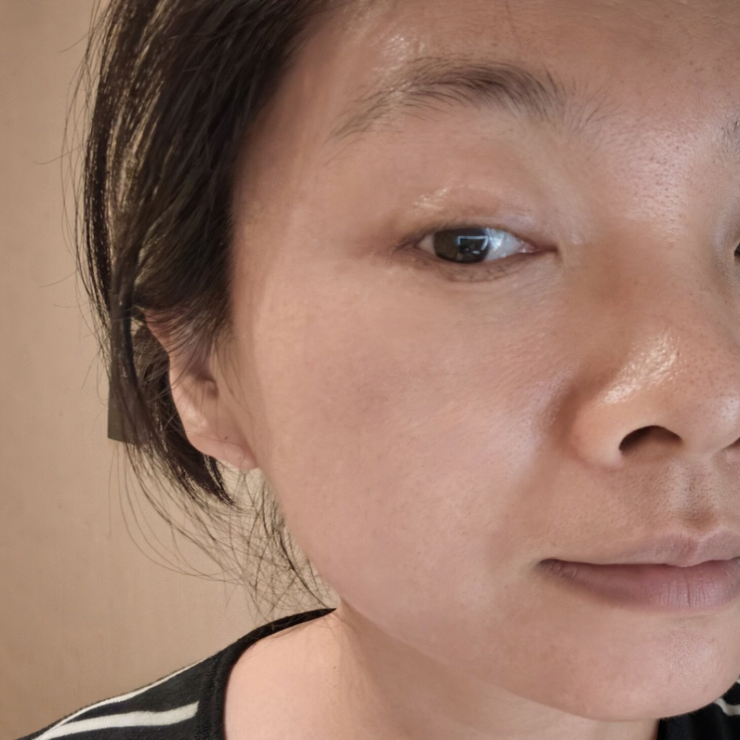 do脸后脸又红又烫，别急着敷面膜：项目修护就三个阶段