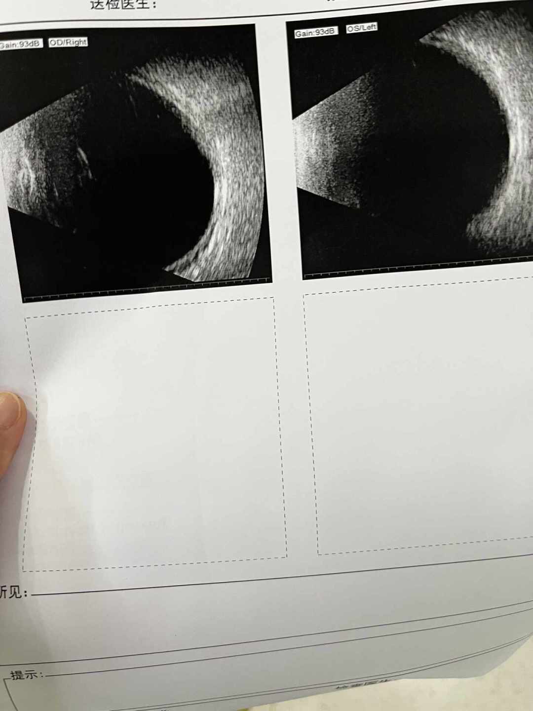 双11新机到家先别急着添第二台：我把全网原厂压脚、没敢动的线迹盘和“压脚抬还是放”的争论，摆成一张30天清单