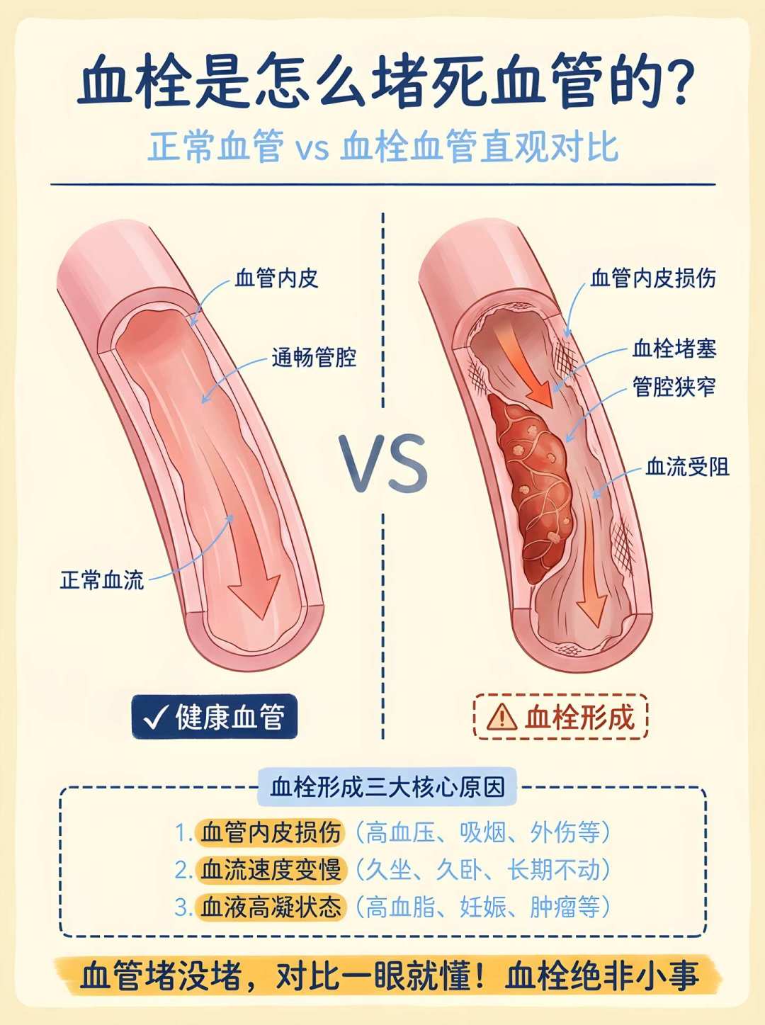 拜耳卒中防复发新药刚公布,就拿了