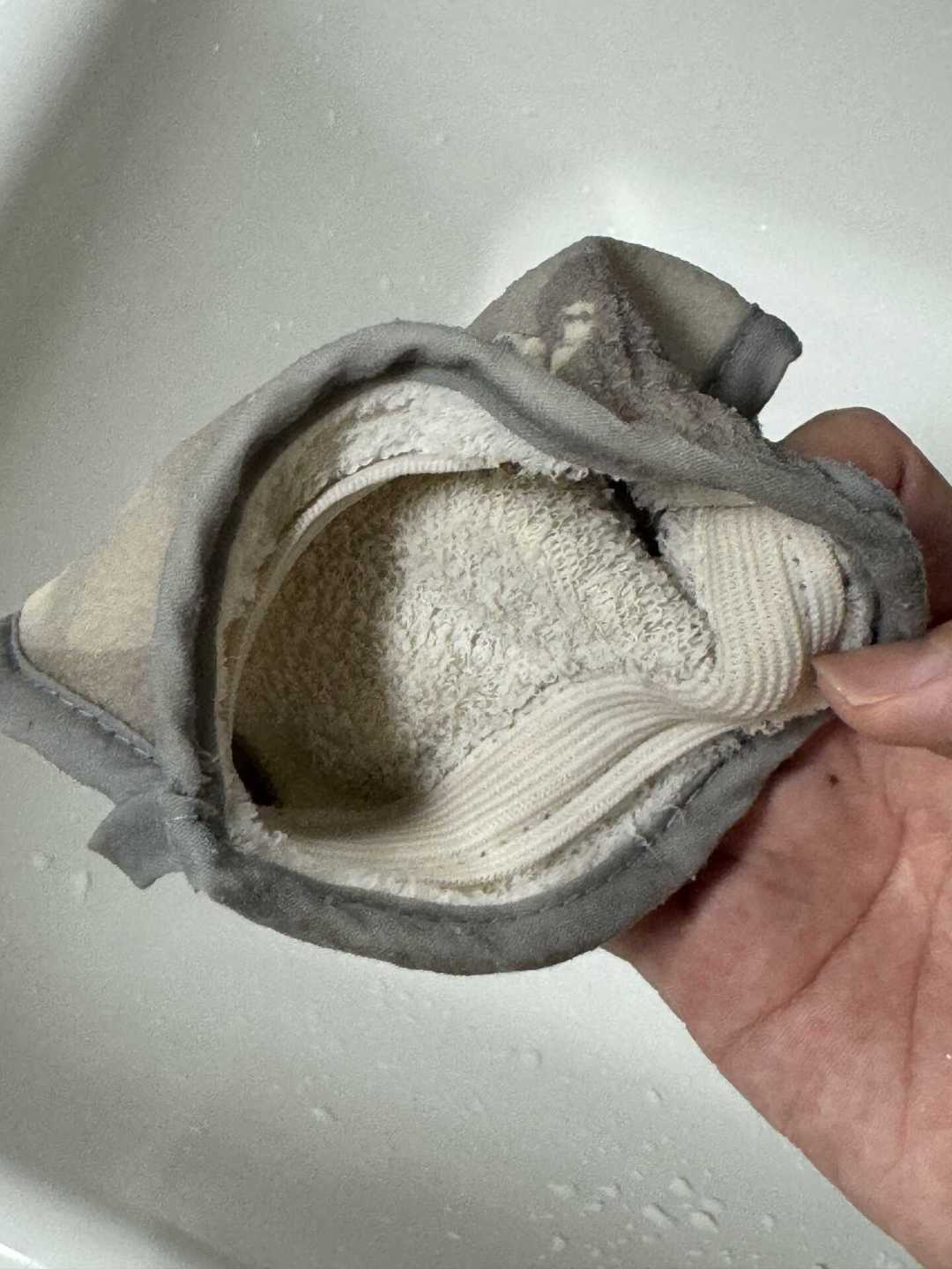 胳膊上的小疙瘩越搓越糟?鸡皮肤不是没洗干净,这3件事才真有用