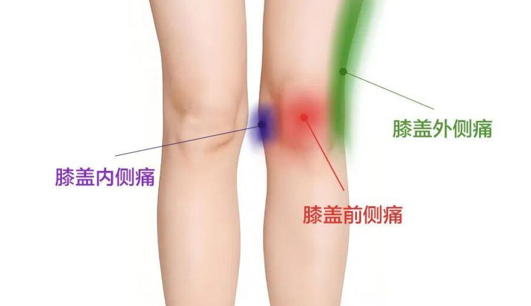 膝盖疼痛位置示意图