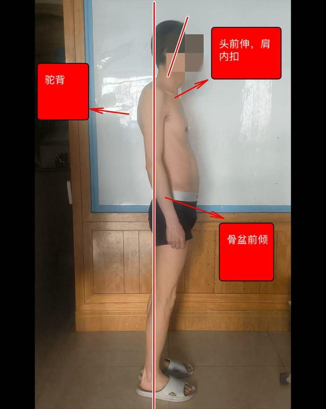 800砍到400的肩颈按摩仪治不好颈椎病：双11付尾款前记住这5个数